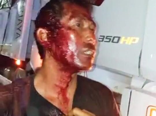 Supir Truk BKPN Jadi Korban Lemparan Batu Oleh OTK Dijalan Raya Pakuhaji, Kepala Robek Hingga 6 Jahitan